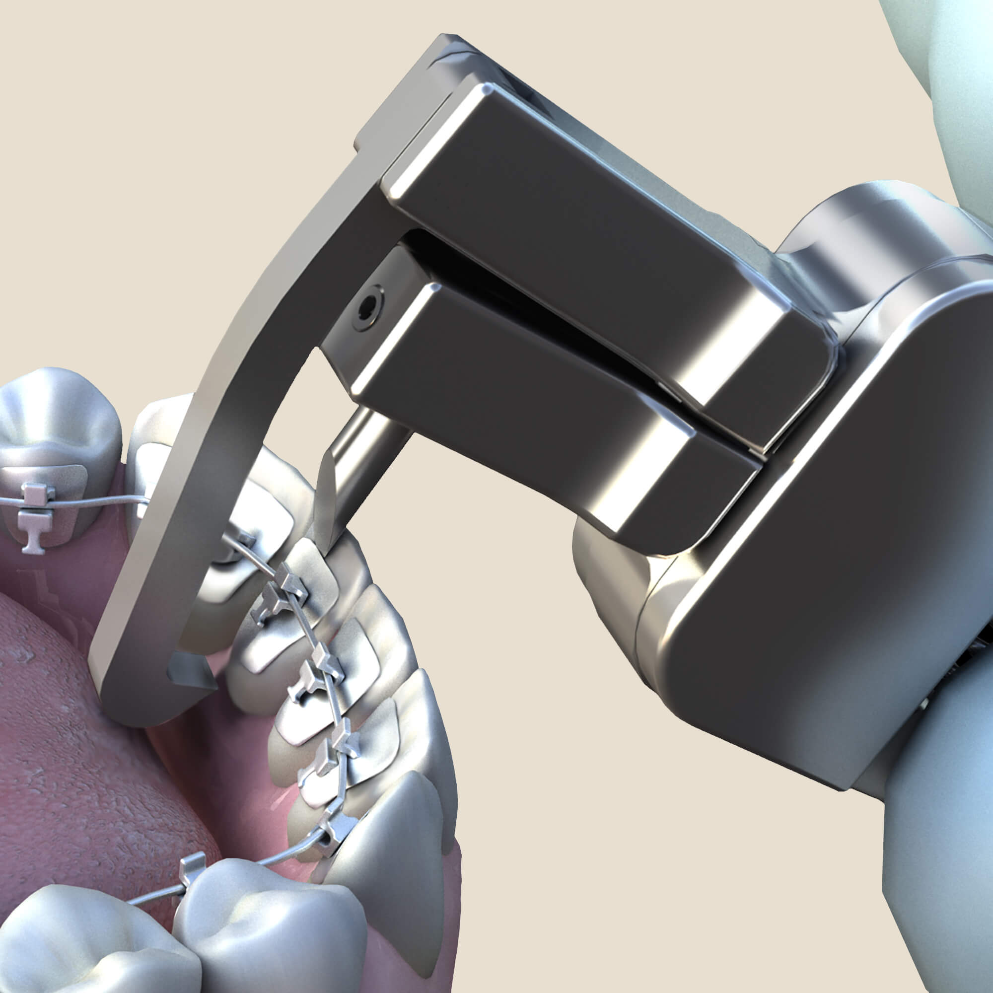 Lingual Debonding Pliers