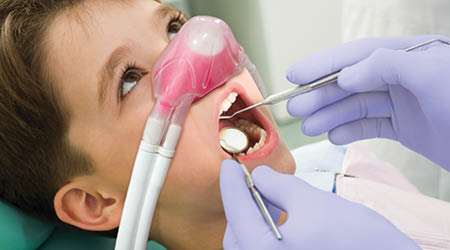 Nitrous Oxide/Oxygen Sedation