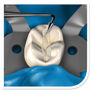 Black Line Illustration