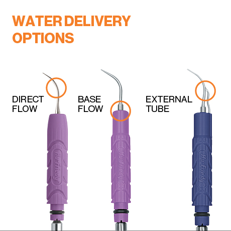 Water Delivery Differences